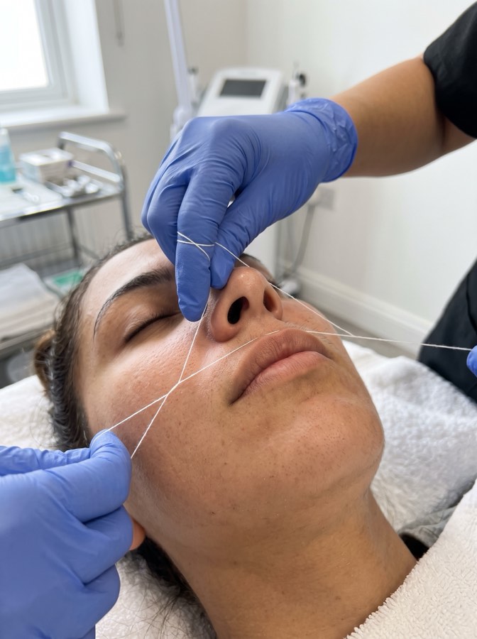 Labio superior con hilo
