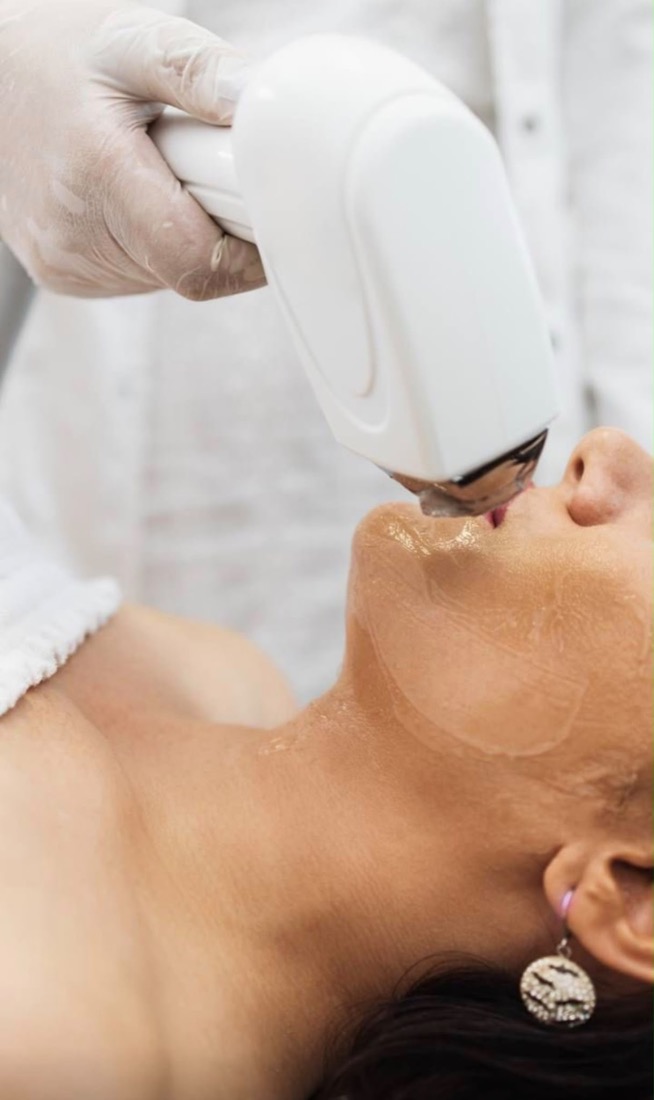Láser facial IPL en Divas Skin Care