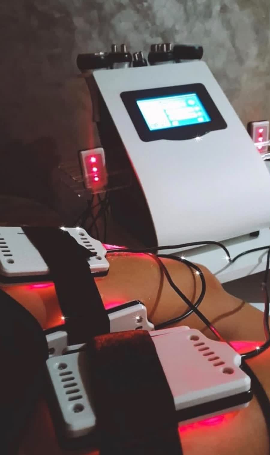 Lipoláser + Presoterapia